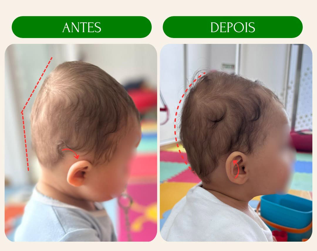 antes_e_depois_10