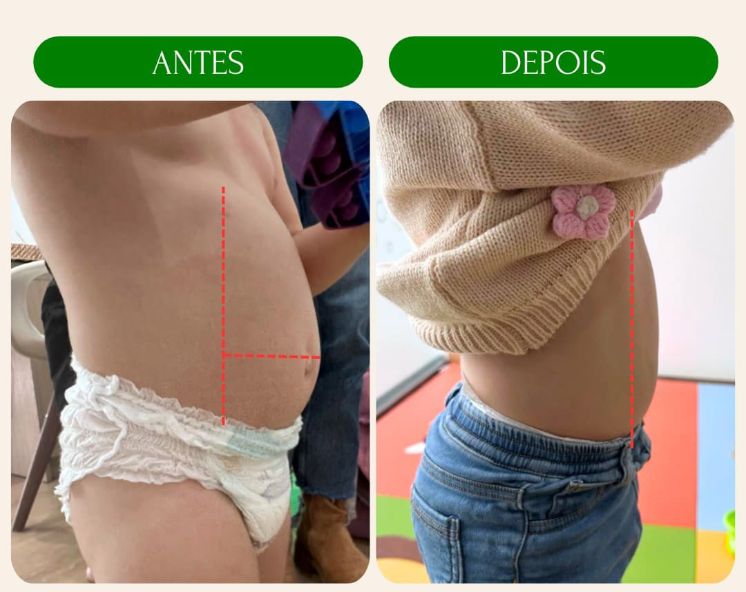 antes_e_depois_2