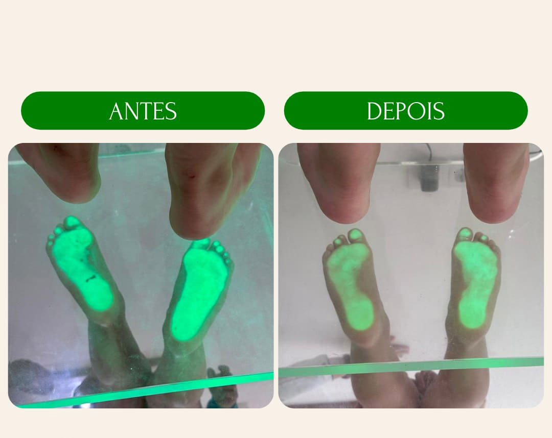 antes_e_depois_3