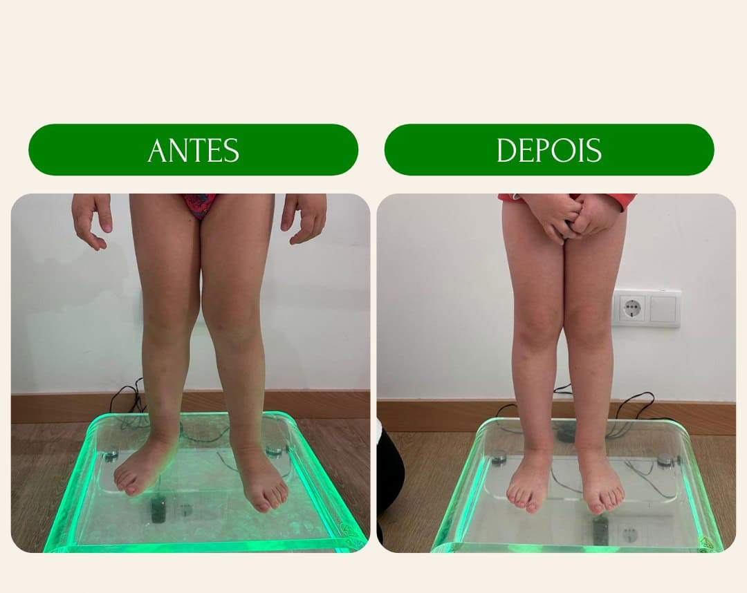 antes_e_depois_4