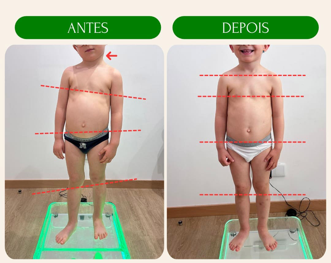 antes_e_depois_5