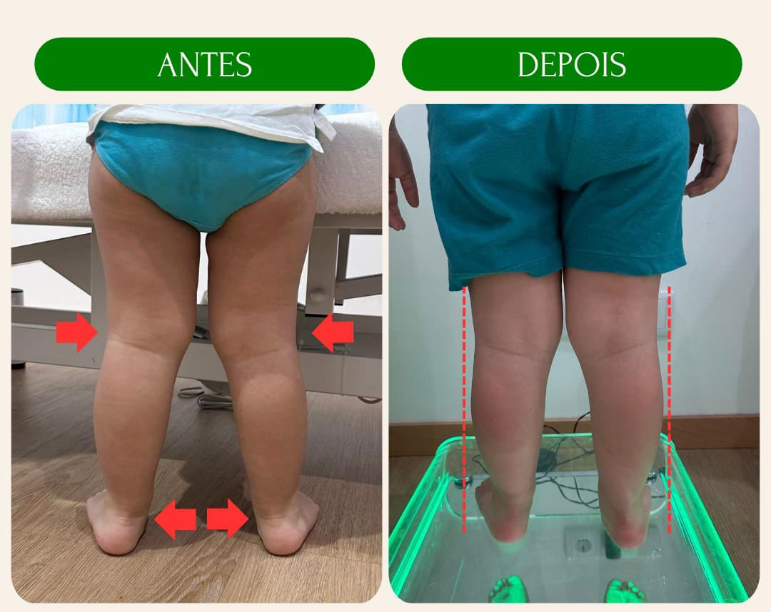 antes_e_depois_6