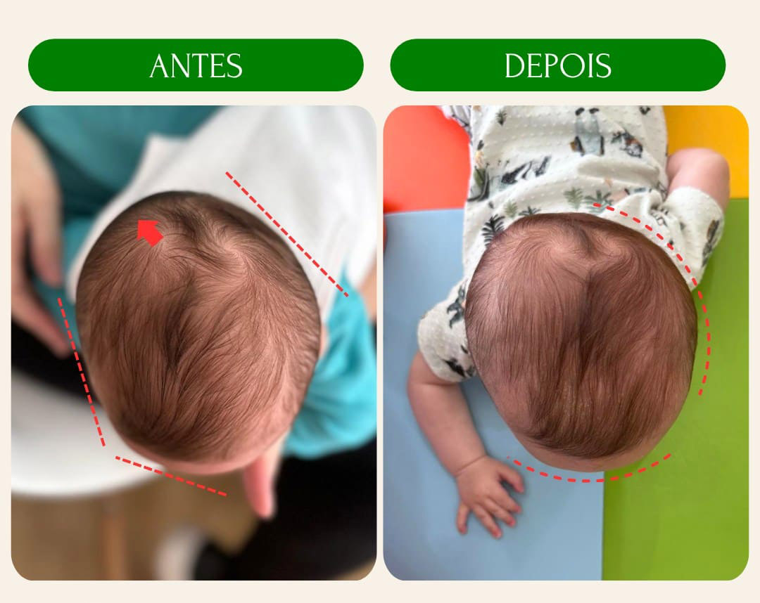 antes_e_depois_7