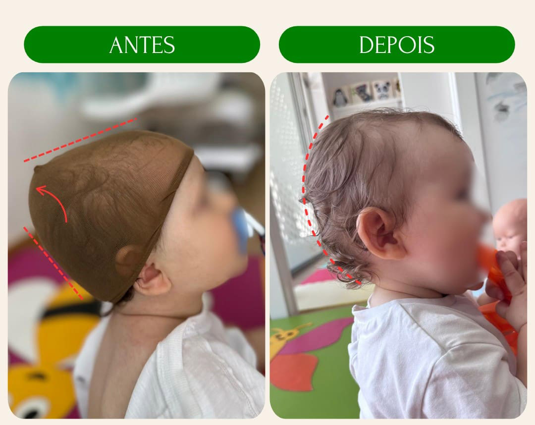 antes_e_depois_8