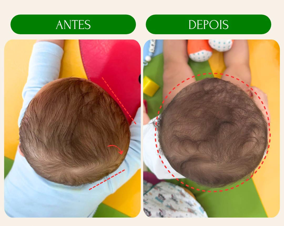 antes_e_depois_9